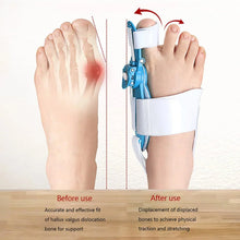 Adjustable Bunion Support Splint – Hallux Valgus Corrector for Men & Women - Justgrabit Inc.