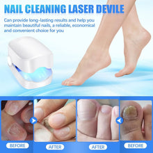 Rechargeable Nail Fungus Laser – Anti - Fungal Device for Toenails, Hands & Feet (Home Use) - Justgrabit Inc.