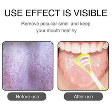 Oral Tongue Cleaner Brush Scraper Health Personal Care Dental Care Tongue Cleaner (1 Pc / Multicolor) - justgrabit.in | Just Grab It