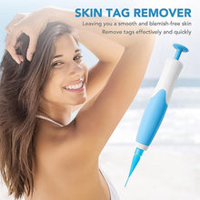Skin Tag Remover Kit 2 in 1 for Micro to Large (2 mm - 8 mm / 1 Set) - justgrabit.in | Just Grab It