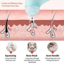 Mini Handheld Vacuum Blackhead Remover – Facial Massage & Spot Lifting (1 Pc) - justgrabit.in | Just Grab It