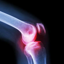 Knee Cap for Knee Support (Large) - Justgrabit Inc.