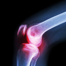 (XL) Knee Cap for Knee Support - Justgrabit Inc.