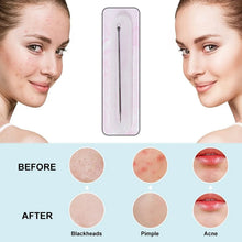 Blackhead Remover Needle (1 Pc / With Case) - justgrabit.in | Just Grab It
