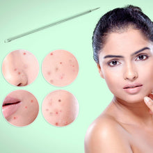 Blackhead Remover Needle (1 Pc / With Case) - justgrabit.in | Just Grab It