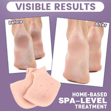 Anti Crack Silicone Half Gel Heel And Foot Protector Moisturizing Socks - Justgrabit Inc.
