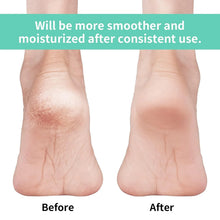 Anti Crack Silicon Gel Heel Moisturizing Socks for Foot Care Men Women (Loose Pack) - Justgrabit Inc.