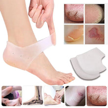 Moisturizing Skin Softening Silicone Gel for Dry Cracked Heel Repair (Multicolour) - Justgrabit Inc.